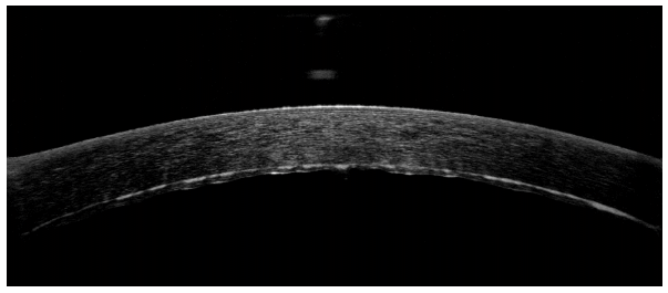 ZY016_34_2.gif
